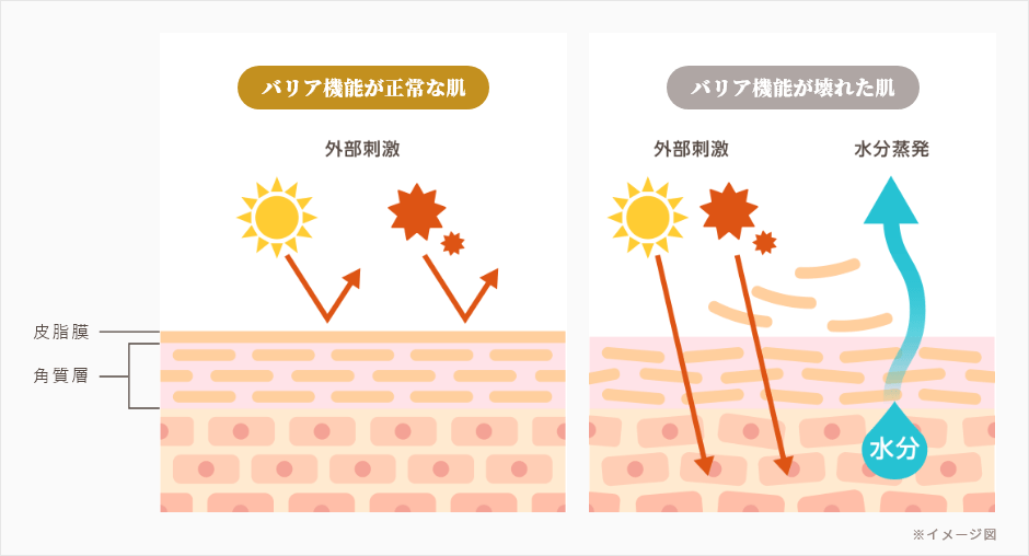 バリア機能が正常な肌とバリア機能が壊れた肌